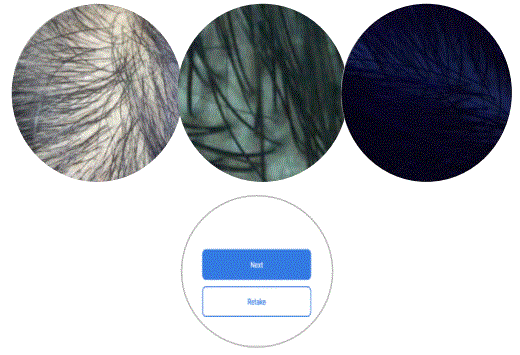 CHOWIS-Dermo-Pico-dpi-harris-Mobile-Hair-Analyzer-FIG-13