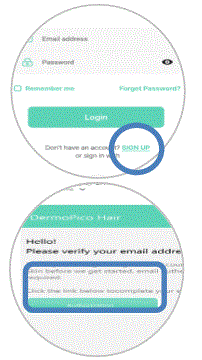 CHOWIS-Dermo-Pico-dpi-harris-Mobile-Hair-Analyzer-FIG-22