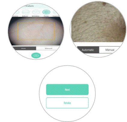 CHOWIS-Dermo-Pico-dpi-harris-Mobile-Hair-Analyzer-FIG-29