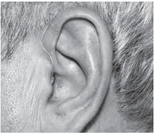 SOUNDWORLD-HD75-Series-OTC-Hearing-Aid-FIG-5