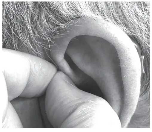 SOUNDWORLD-HD75-Series-OTC-Hearing-Aid-FIG-6