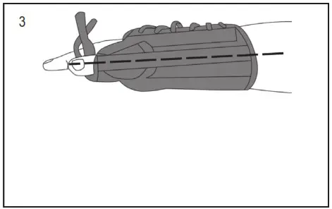 HELY WEBER 6893410 Titan Thumb Lacing Orthosis - overview 3