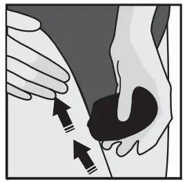 UNDERARM/BIKINI AREA EPILATION