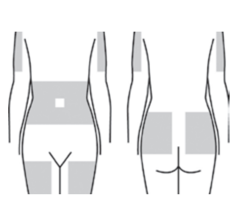 Step-by-Step Instructions for Subcutaneous Administration