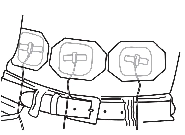 Step-by-Step Instructions for Subcutaneous Administration