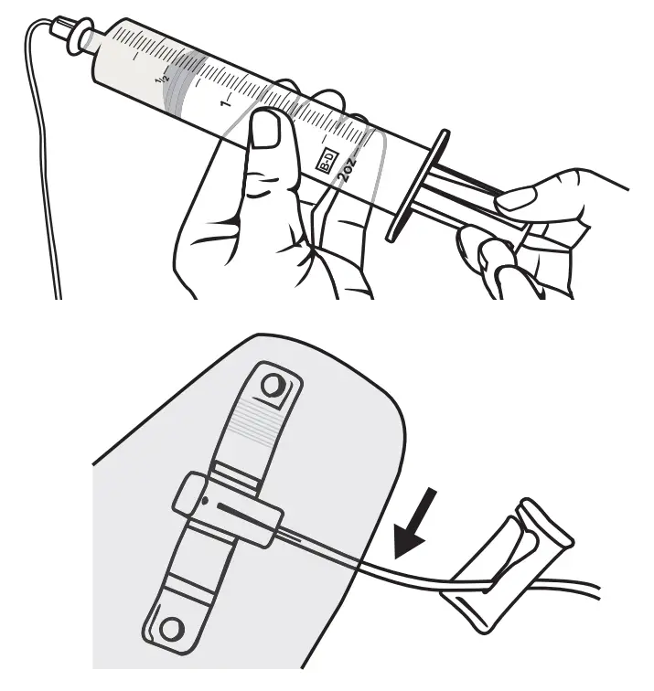 Step-by-Step Instructions for Subcutaneous Administration