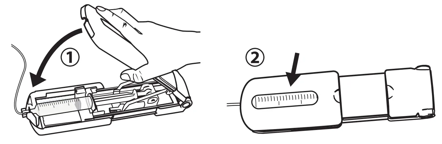 Step-by-Step Instructions for Subcutaneous Administration