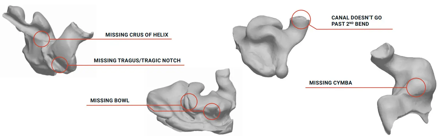 AUDIOLOGIST Custom In Ear Monitors - BAD IMPRESSIONS
