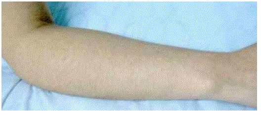 Handy-Importer-810nm-Diode-Laser-Hair-Removal-Device-fig-18