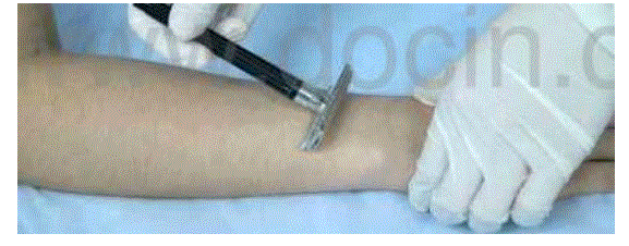 Handy-Importer-810nm-Diode-Laser-Hair-Removal-Device-fig-19