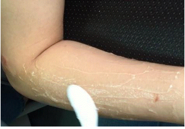 Handy-Importer-810nm-Diode-Laser-Hair-Removal-Device-fig-20