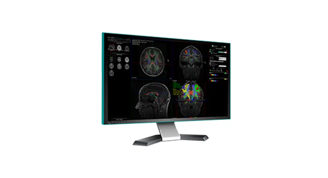 Nordicneurolab Nordicbrainex Clinical Neuroimaging Software For Functional Mri Instruction Manual