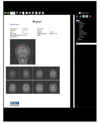 NordicNeuroLab nordicBrainEx Clinical Neuroimaging Software for Functional MRI - fig 3