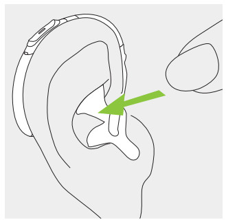 PHONAK M90 PR Rechargeable Hearing Aid - FIG 17