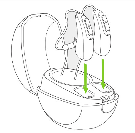 PHONAK M90 PR Rechargeable Hearing Aid - FIG 9