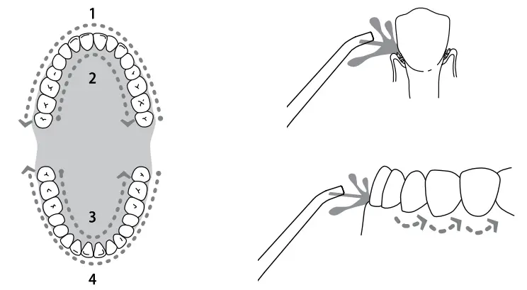 Y-BRUSH-FC3840-Water-Flosser-FIG-8