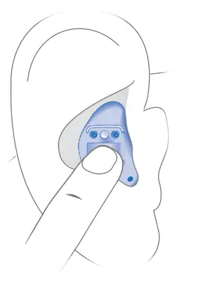 Miracle-Ear MEMINI Mirage IIC Hearing Aid - hearing