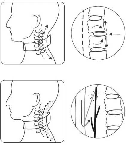 Well Health WH-NM Neck Massager-fig1