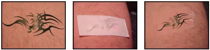 Avance Beauty IPL350-PRJ E-Light Flux Professional IPL Photo-Rejuvenation System - IPL Tattoo Removal