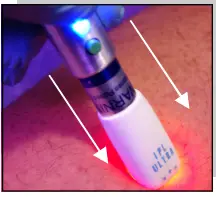 Avance Beauty IPL350-PRJ E-Light Flux Professional IPL Photo-Rejuvenation System - Pulsed Light1