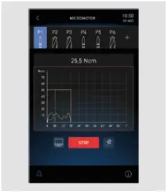 STERN-WEBER-S380TRC-Dental-Treatment-Unit-with-Chair-24