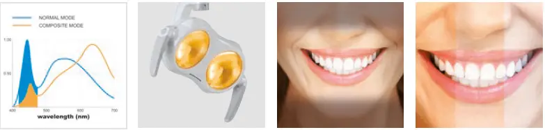 STERN-WEBER-S380TRC-Dental-Treatment-Unit-with-Chair-27