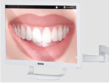 STERN-WEBER-S380TRC-Dental-Treatment-Unit-with-Chair-44