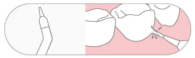 COSLUS F5029A Water Dental Flosser Teeth Pick - Nozzle 3