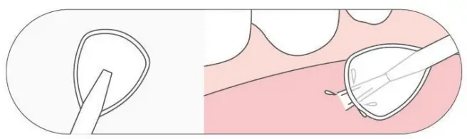 COSLUS F5029A Water Dental Flosser Teeth Pick - Nozzle 4