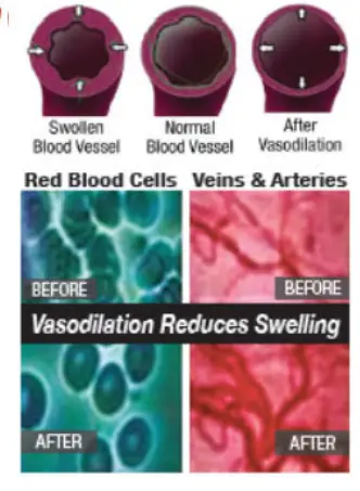 Spectra THERAPY Equine ST Laser Blanket - Vascular