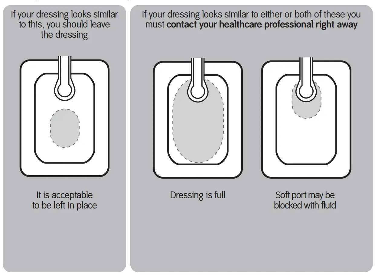 Does your dressing look full?