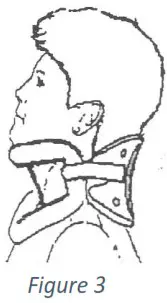 Trulife JS 4040 S Malibu Cervical Orthosis - Fitting 3