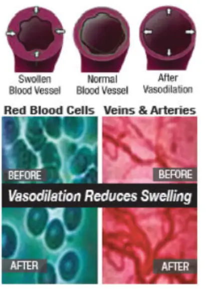 Spectra THERAPY Canine Dog Coat - LASERwrap6