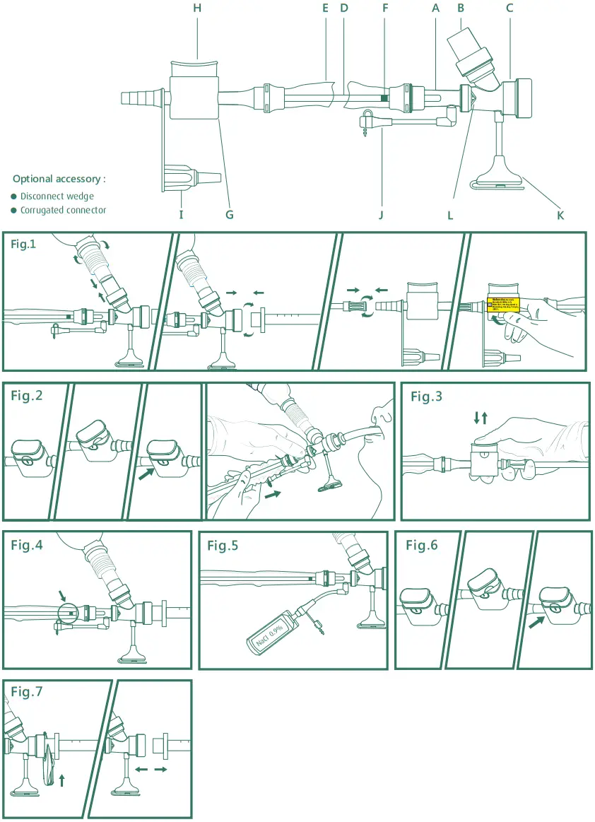 SUNSET HEALTHCARE SOLUTIONS VEN56051000A Standard 72hr Closed Suction System