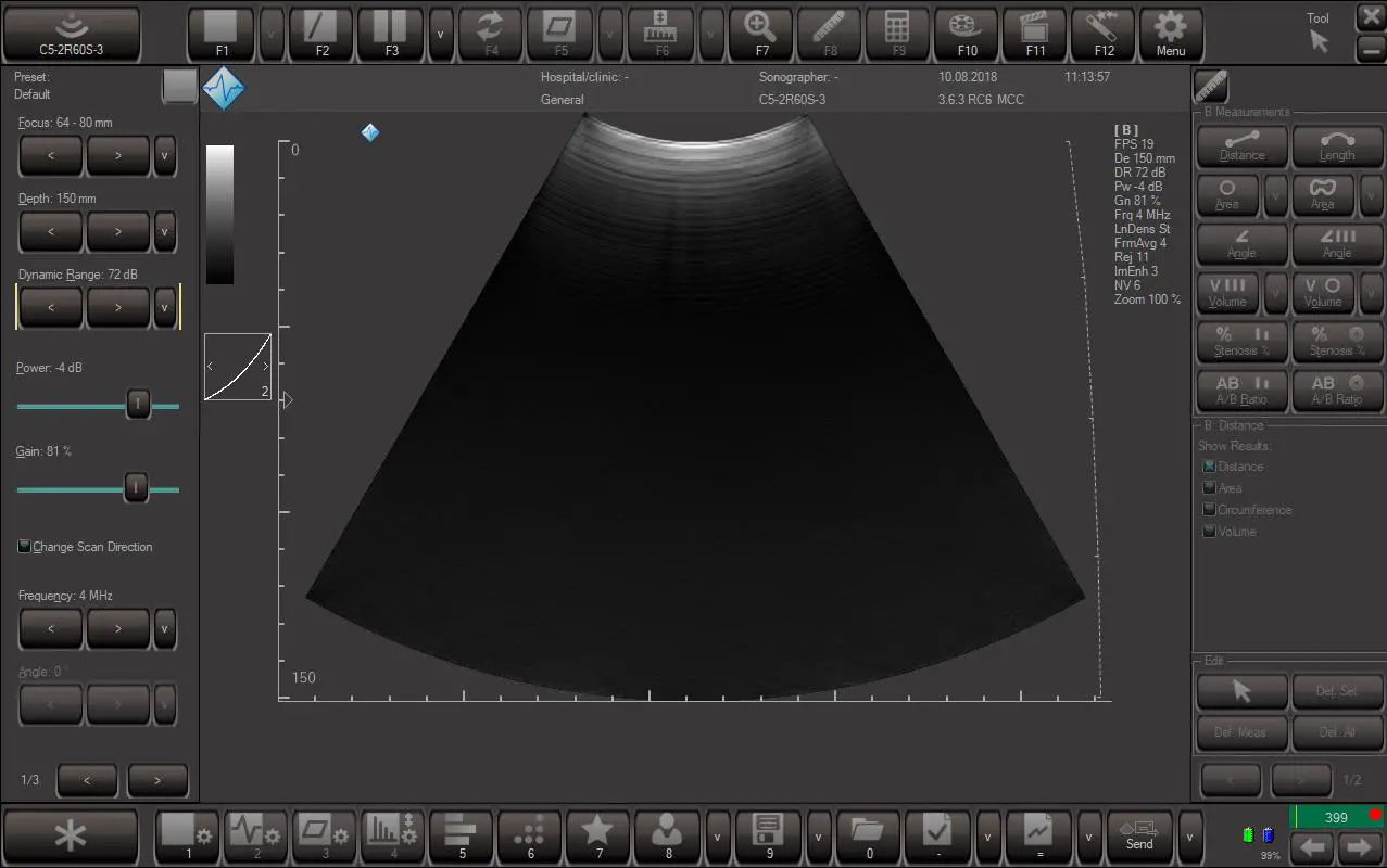 TELEMED-Echo-Wave-II-Software-18