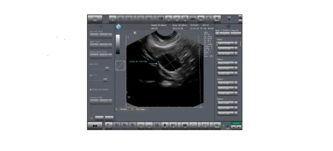 Telemed Echo Wave Ii Software User Guide Telemed Echo Wave Ii Software User Guide