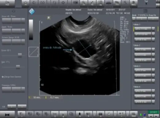 TELEMED-Echo-Wave-II-Software-product-image