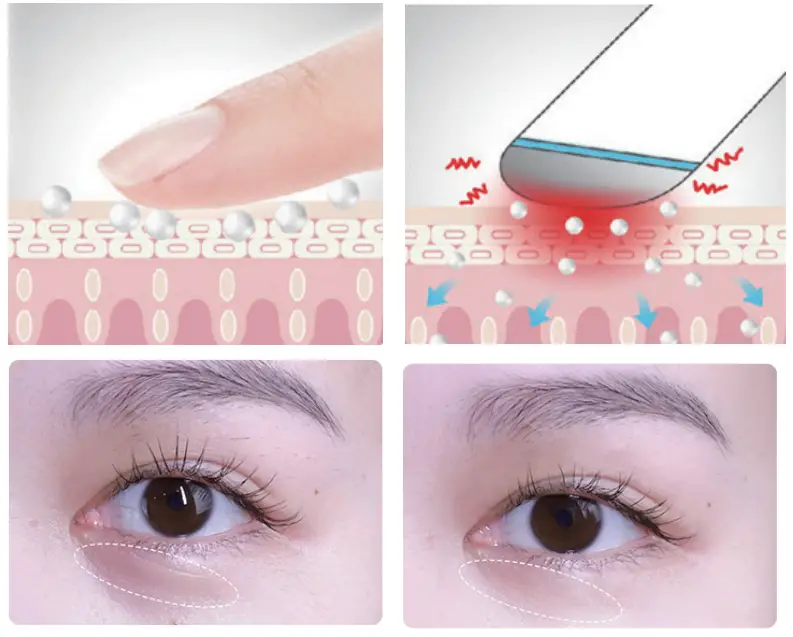BEAUTIFLY Look Young Series Eye Massager - Diagram