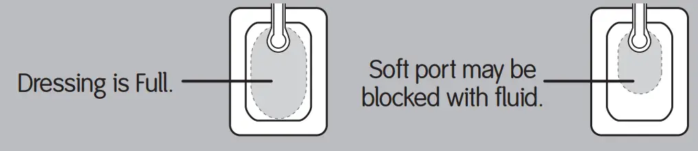 smith nephew PICO 7 Patient and Caregiver - dressing look1