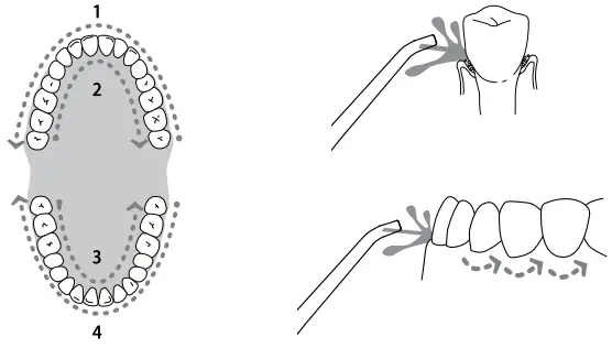 Nicefeel FC5170 Portable Oral Irrigator - After Use