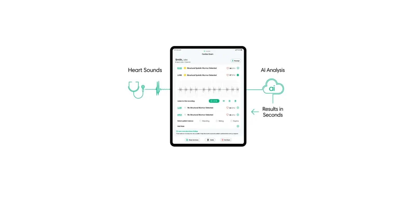 Eko Murmur Analysis Software User Manual