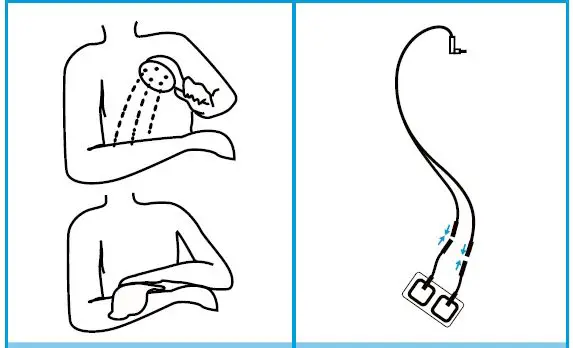 AUVON-TU3424-F-Tens-and-Ems-Device-FIG-1