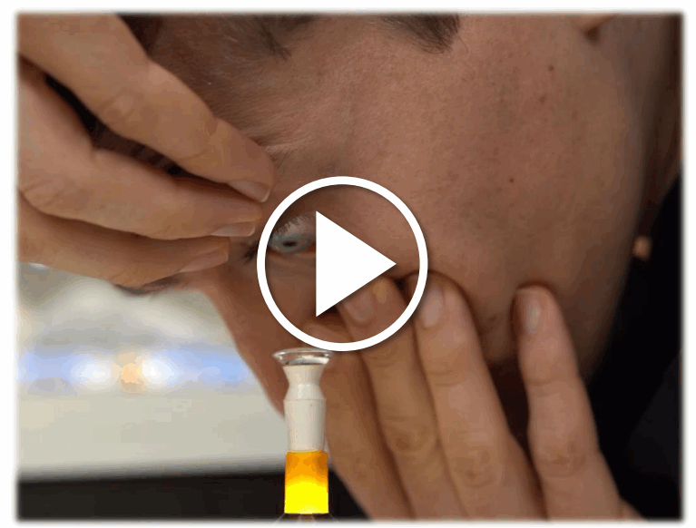 AUGMENTED VISION LABS S5 Mini Hybrid Lens Insertion System - SPECIAL OFFER