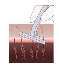 LUMENESSA-LS101-IPL-Hair-Removal-Device-FIG- (4)