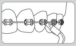 Waterpik-WF-05-Whitening-Water-Flosser-FIG-15