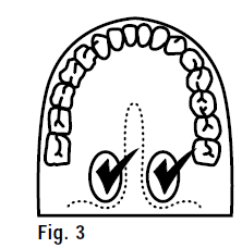Vicks Thermometer Battery V911F fig-3