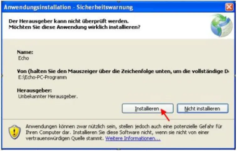 GROTHE 43501 Funkgong Set ECHO Schwarz ECHO M Schwarz - Figure 2