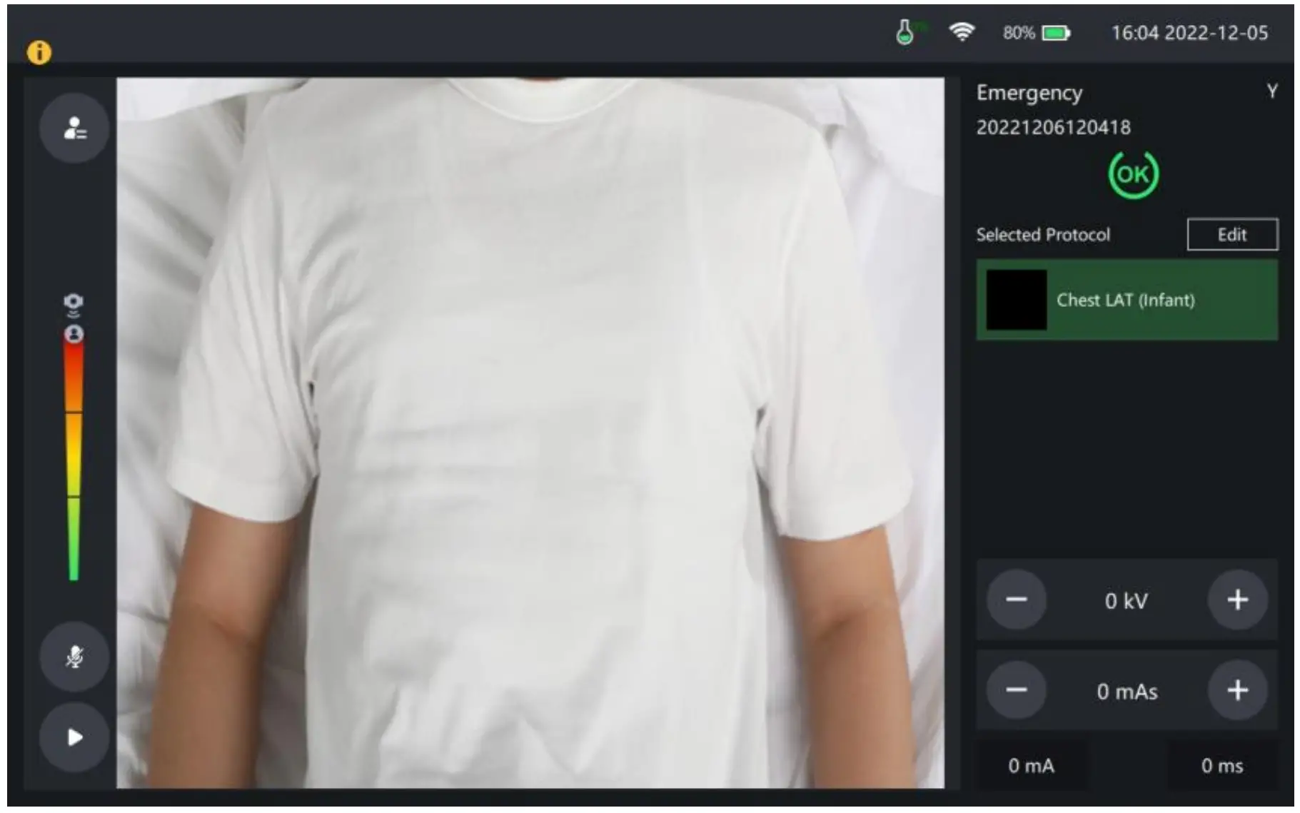 Video monitoring interface of the uVision remote console