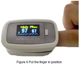 AccuMed-CMS-50D1-Fingertip-Pulse-Oximeter-Blood-Oxygen-Sensor-FIG-5