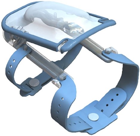 IV Glove IVGA0003 Adult IV Securement Device Models